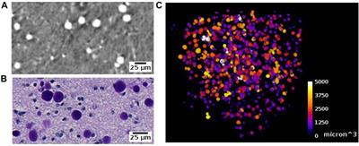 Protocol for 3D virtual histology of unstained human brain tissue using synchrotron radiation phase-contrast microtomography